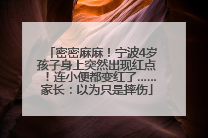 密密麻麻！宁波4岁孩子身上突然出现红点！连小便都变红了……家长：以为只是摔伤